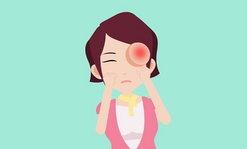 眼睛玩手机肿了怎么快速消肿_玩手机可以把眼睛玩儿瞎吗_眼睛肿可不可以玩手机游戏