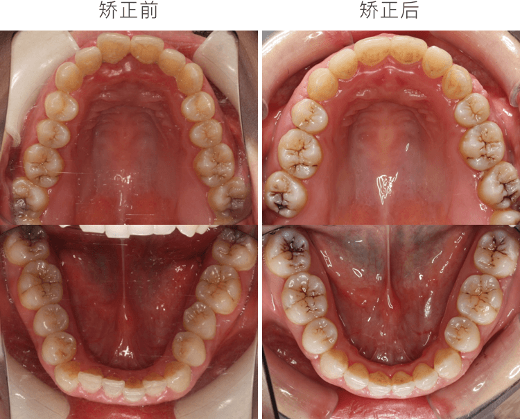 牙斗士真人动漫_牙斗士_牙斗士娘