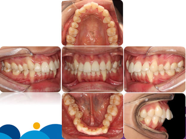 牙斗士真人动漫_牙斗士娘_牙斗士