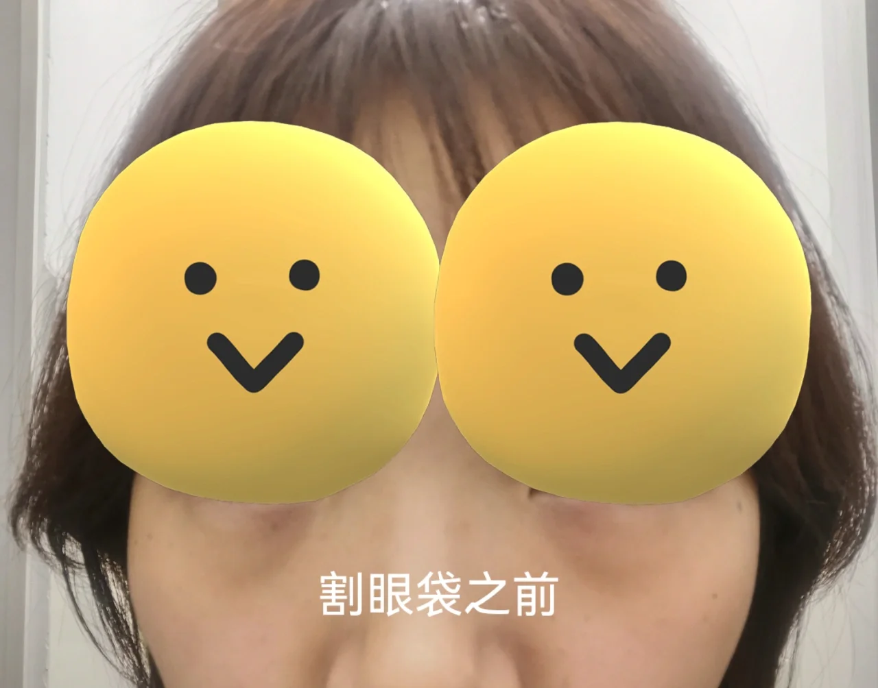 眼袋图片玩手机游戏会有影响吗_眼袋是玩手机玩出来的吗_玩手机游戏会有眼袋吗图片